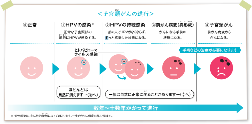 子宮頸がんの進行